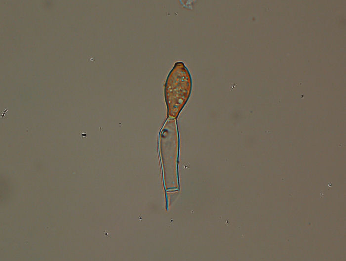 Forse nemmeno una crosta - foto 3364 (Haplotrichum aureum)